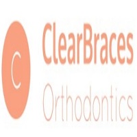 (c) Clearbracesorthodontics1.wordpress.com